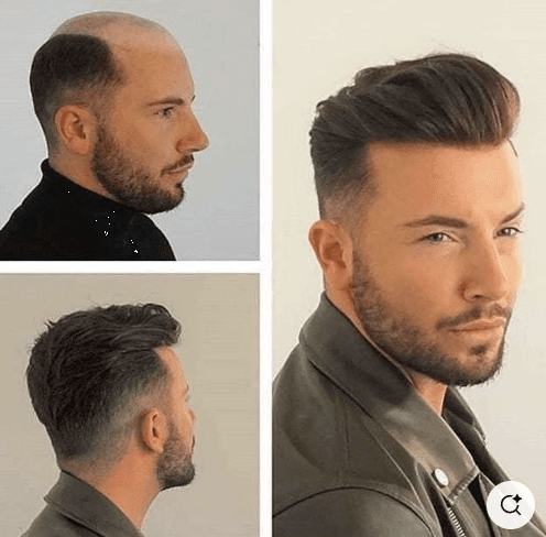 penteado