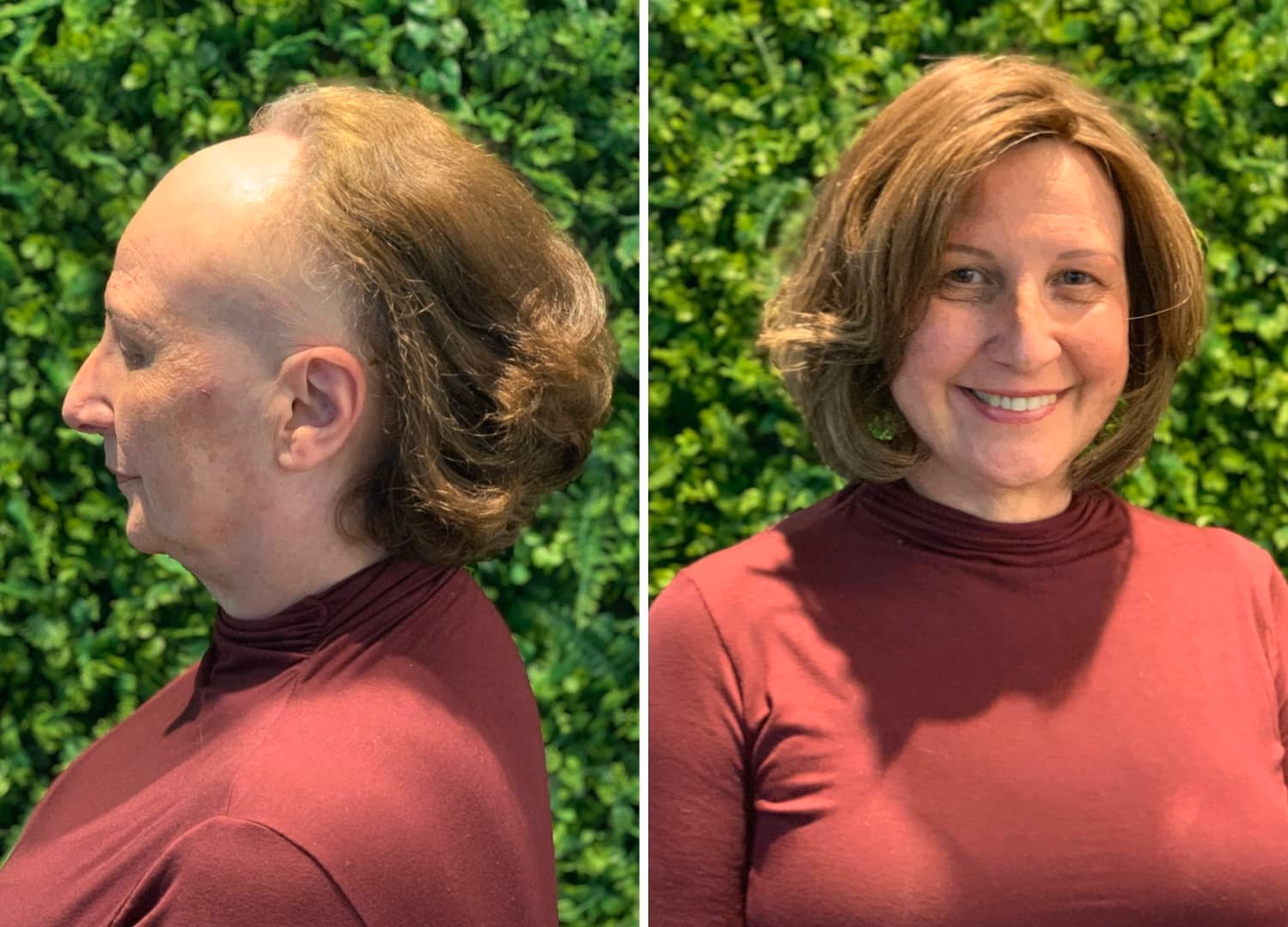 protese-capilar-feminina